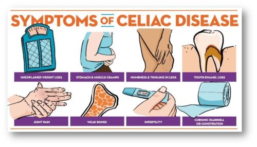 Celiac Disease A Complete Guide Symptoms And Prevention Gluten